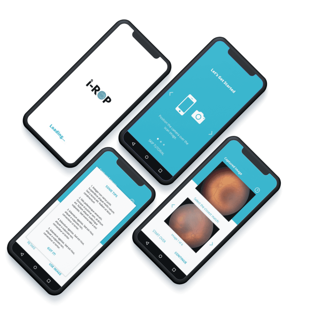 An image depicting the i-ROP app for iOS and Android